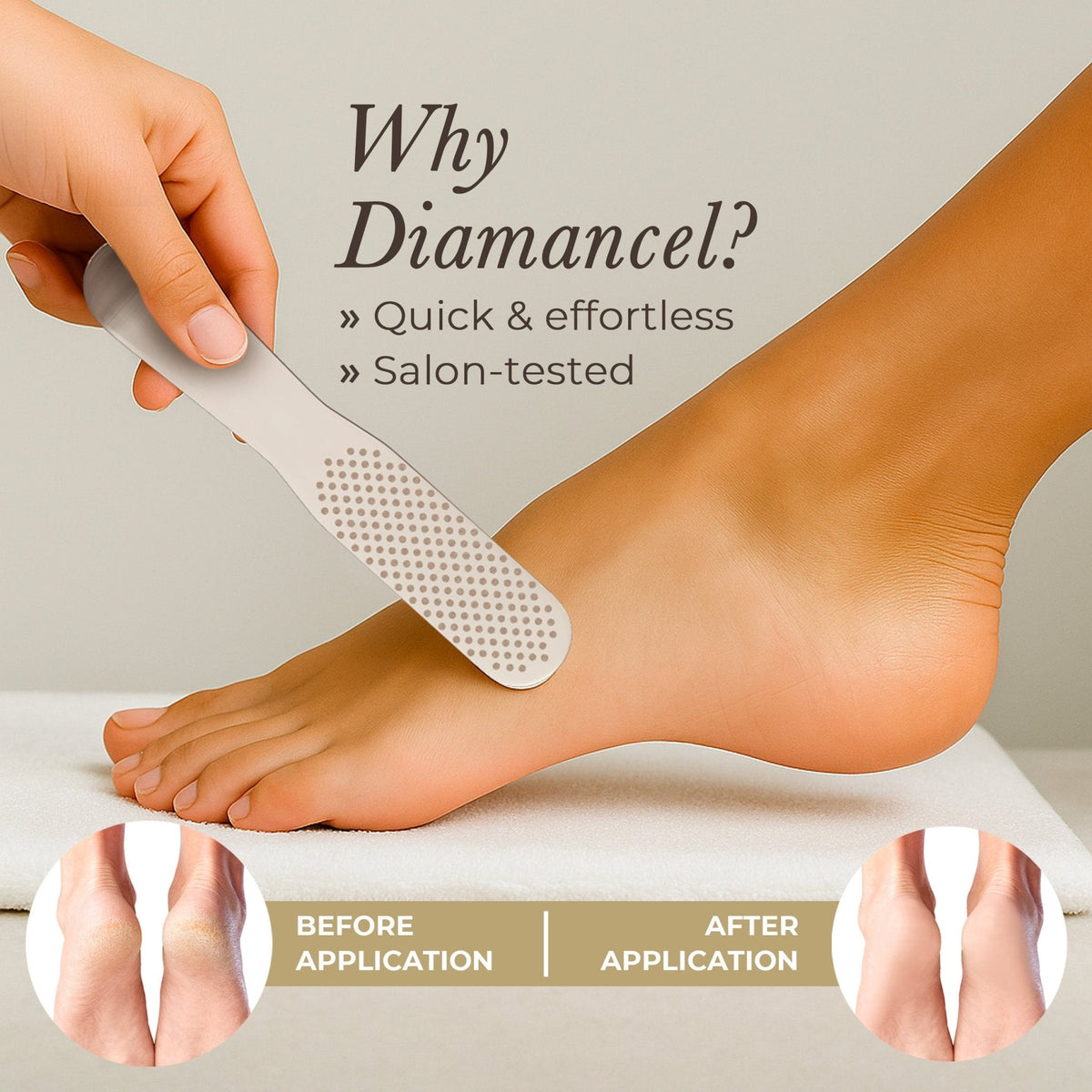 Why the 20 Diamancel Foot File is the Ultimate Callus Remover - Diamancel Europe