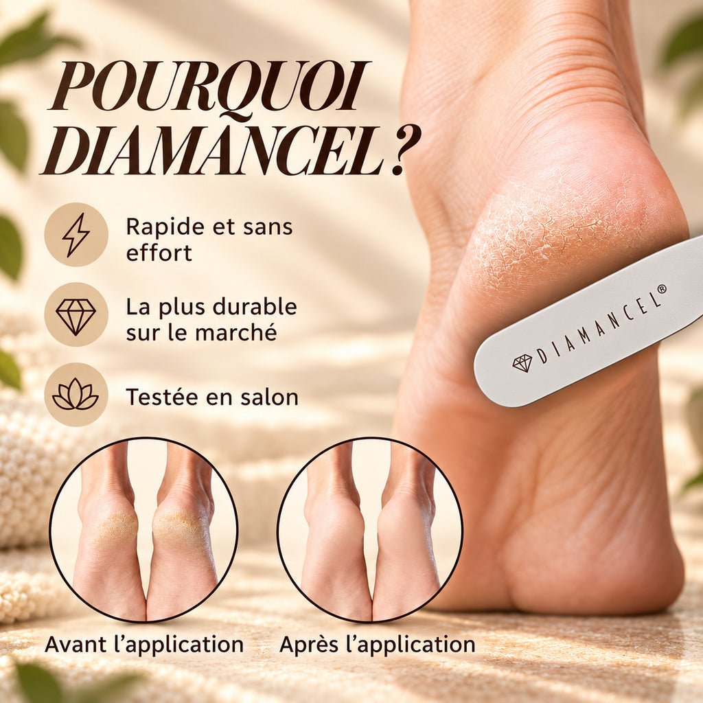Diamancel #20 – Coarse Diamond Foot Callus File - Diamancel Europe